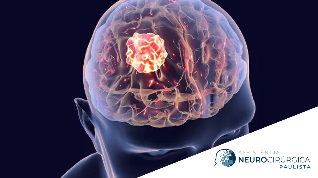 cirurgia cerebral