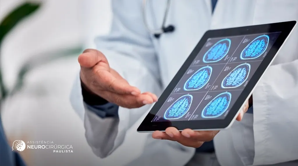 Biomarcadores e exames que ajudam a detectar tumores cerebrais mais cedo