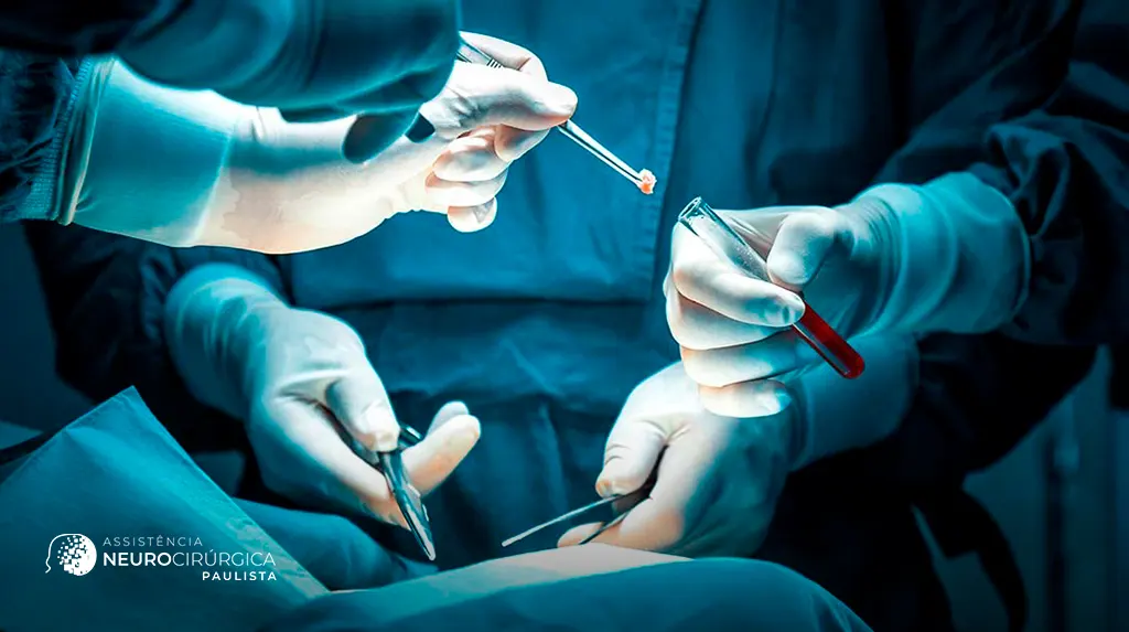 Cirurgia para tumores medulares: quando é necessária?
