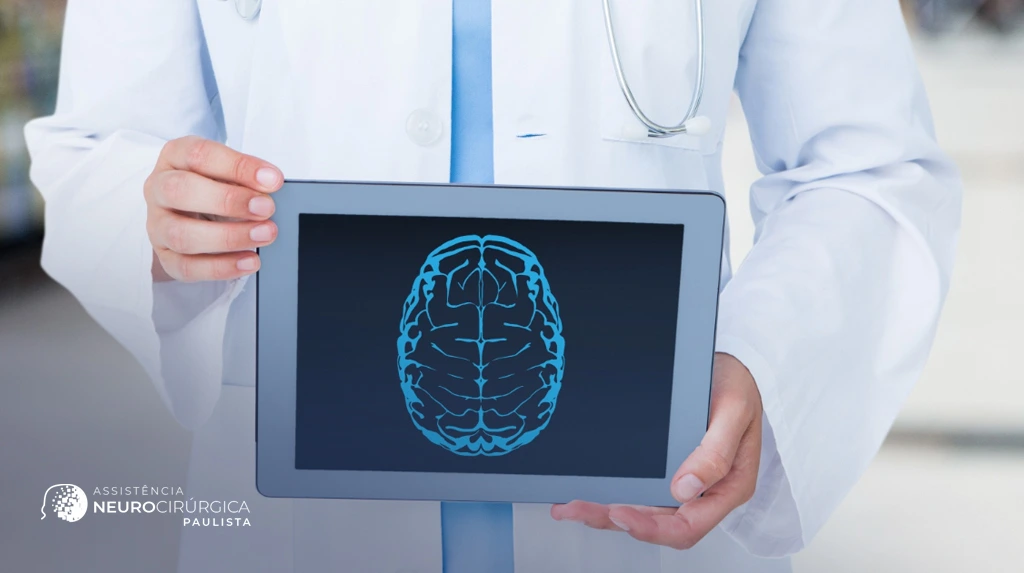 Aneurisma cerebral não é tudo igual: critérios anatômicos que indicam clipagem microcirúrgica