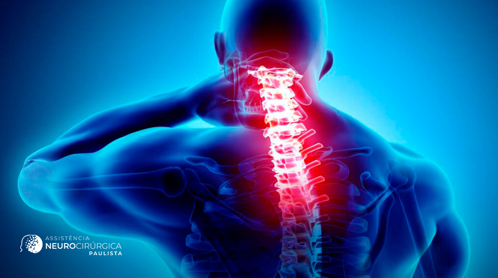 Cirurgia de coluna cervical