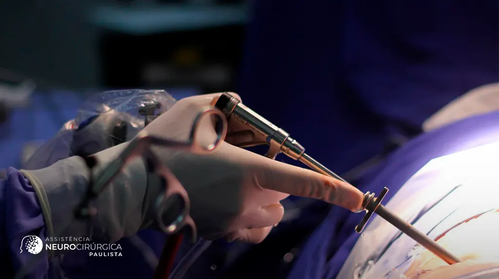 O que é a Endoscopia para Descompressão do Nervo e Quando Ela é Indicada?