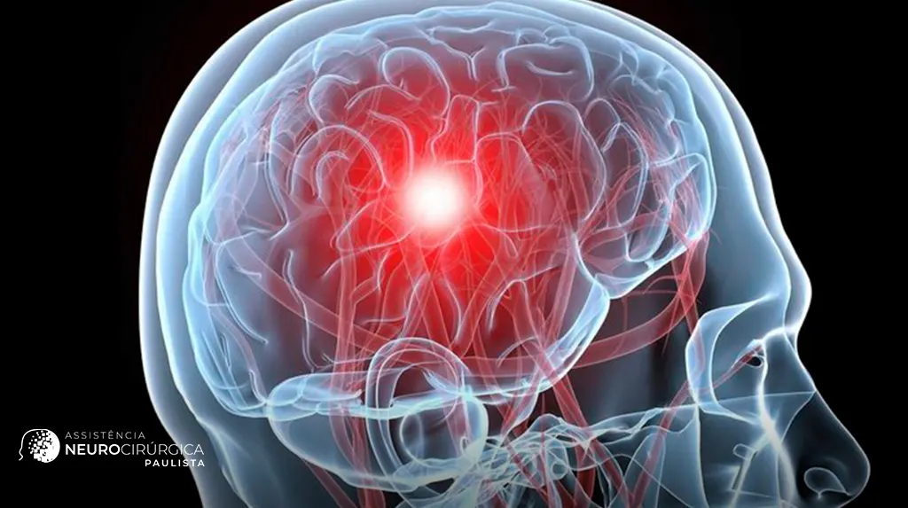 Quais são as principais causas de lesão cerebral e como preveni-las?